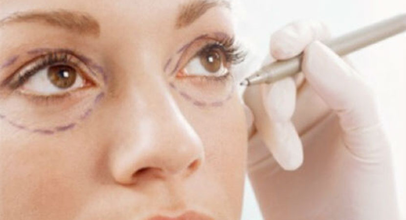 30-home-remedies-to-get-rid-of-under-eye-bags